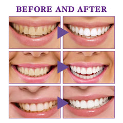 V34 Tooth Cleaning Mousse Value Destination