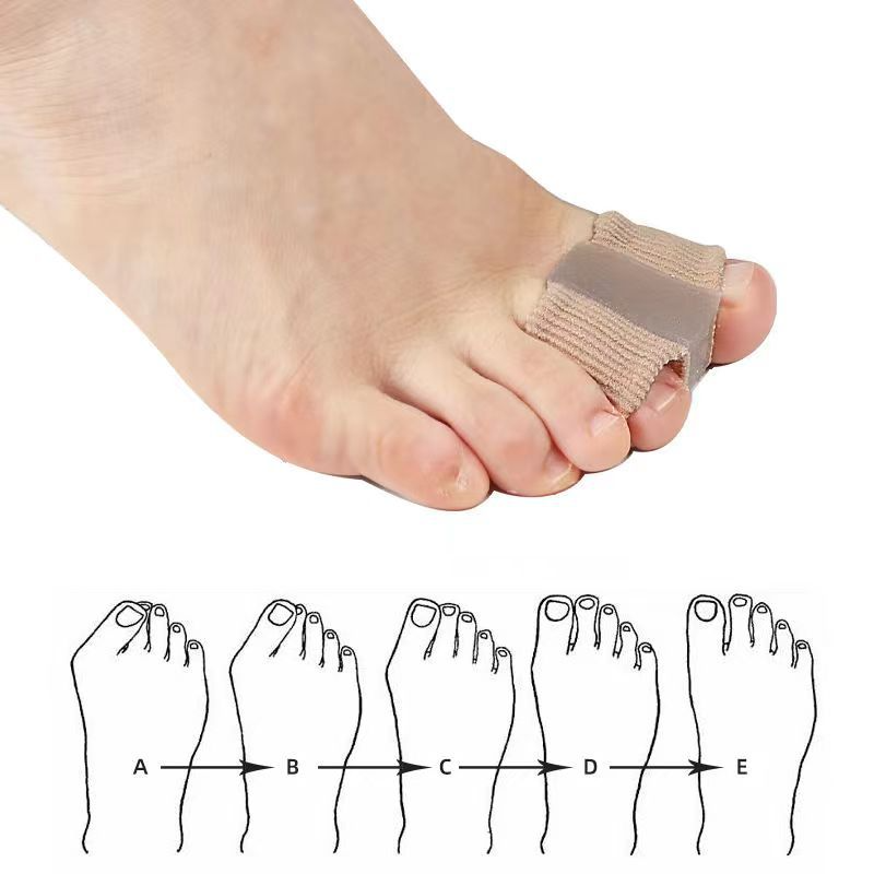 Fiber Toe Separator Value Destination