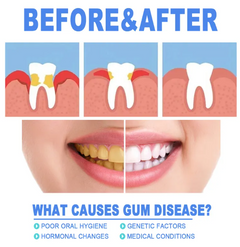 Teeth Repair Gel Value Destination