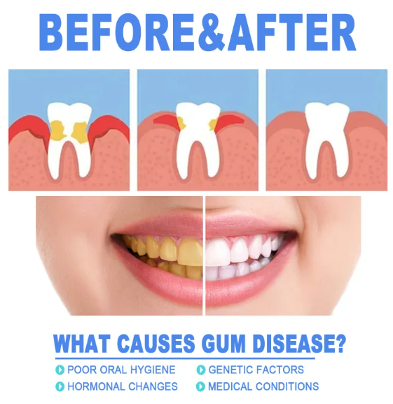 Teeth Repair Gel Value Destination